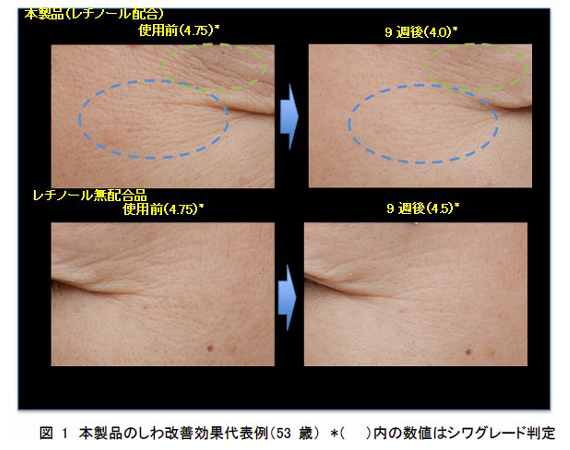 有効成分レチノールによるしわを改善する効能効果の承認を日本で初めて取得　―9週間で「深い」しわを改善―