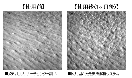 女性ホルモンを整えて、さらに美しく艶やかに。たるみに効く！”美肌ホルモン”を増やす方法